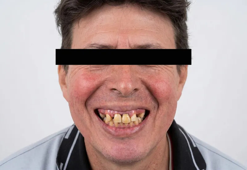 Smile before dental treatment